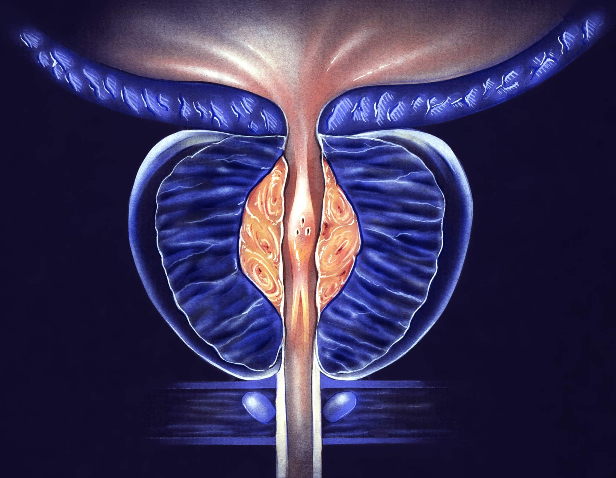 ad-nome-de-prostate-centre-d-imagerie-imef-champigny-sur-marne
