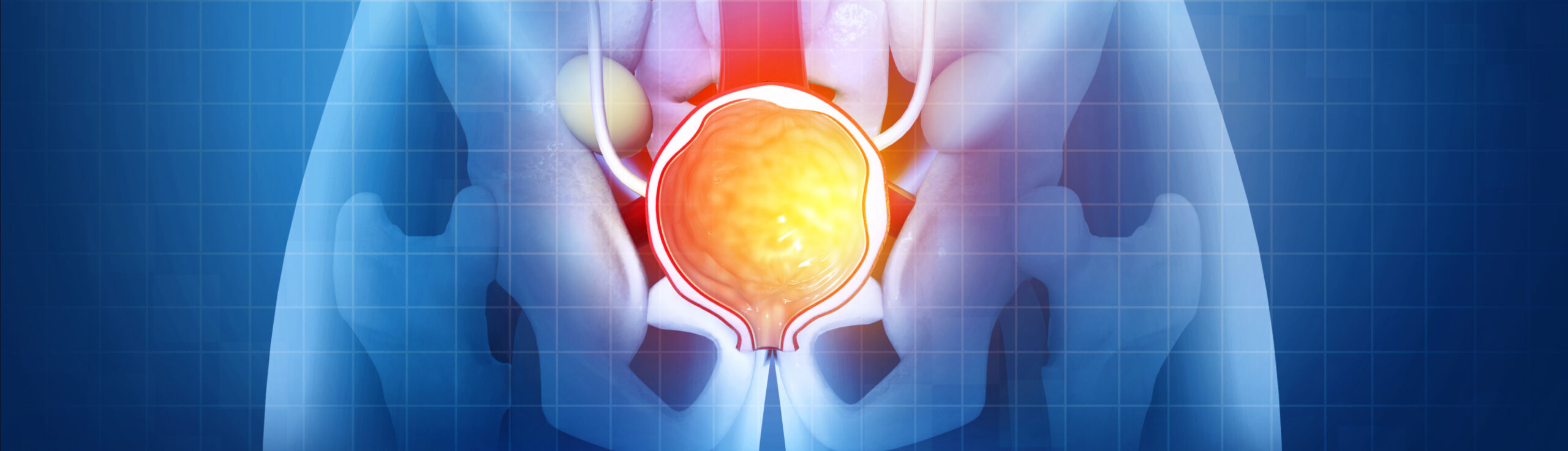 Pourquoi passer une biopsie de la prostate ? | Dr Laouisset | Val-de-Marne